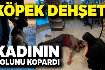 kopek-kadinin-kolunu
