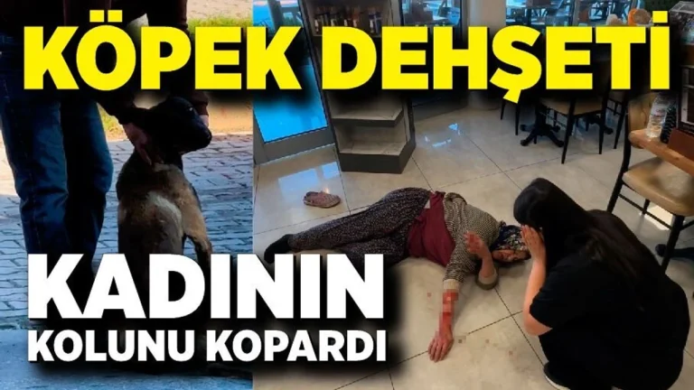 Köpek, saldırdığı kadının kolunu kopardı!